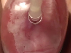 Elle a toujours r�v� d'avoir de grosses l�vres lol