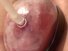 Elle a toujours r�v� d'avoir de grosses l�vres lol