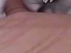 Please dont mind my dark skin patches due to my pcos.