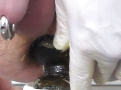 big buttplug extreme anal nearly fisting